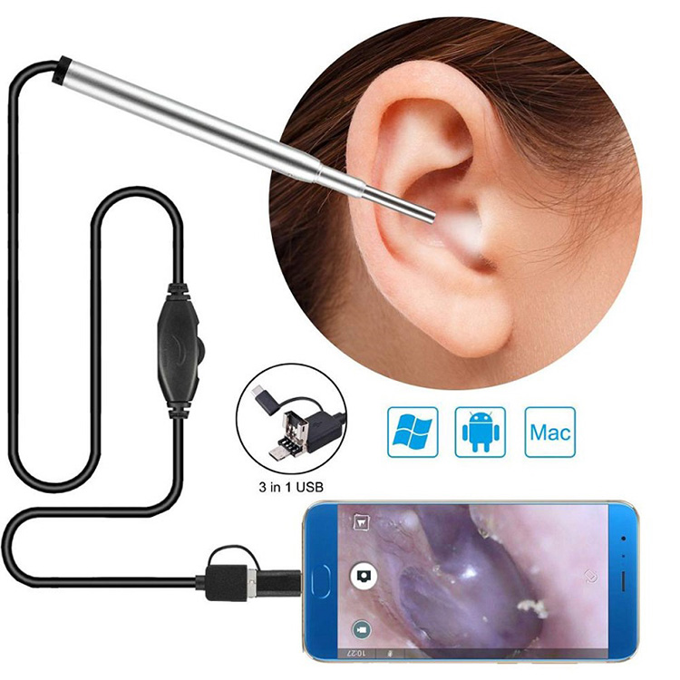 Endoscope médical, appareil photo, oreille, endoscope nasal, otoscope usb